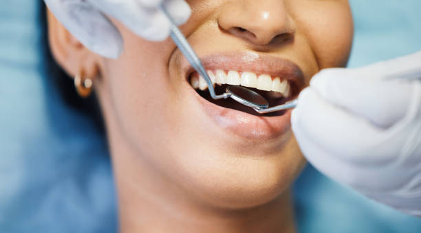 Best Emergency Cosmetic Dentistry (e.g., broken veneers) in Clifton, AZ
